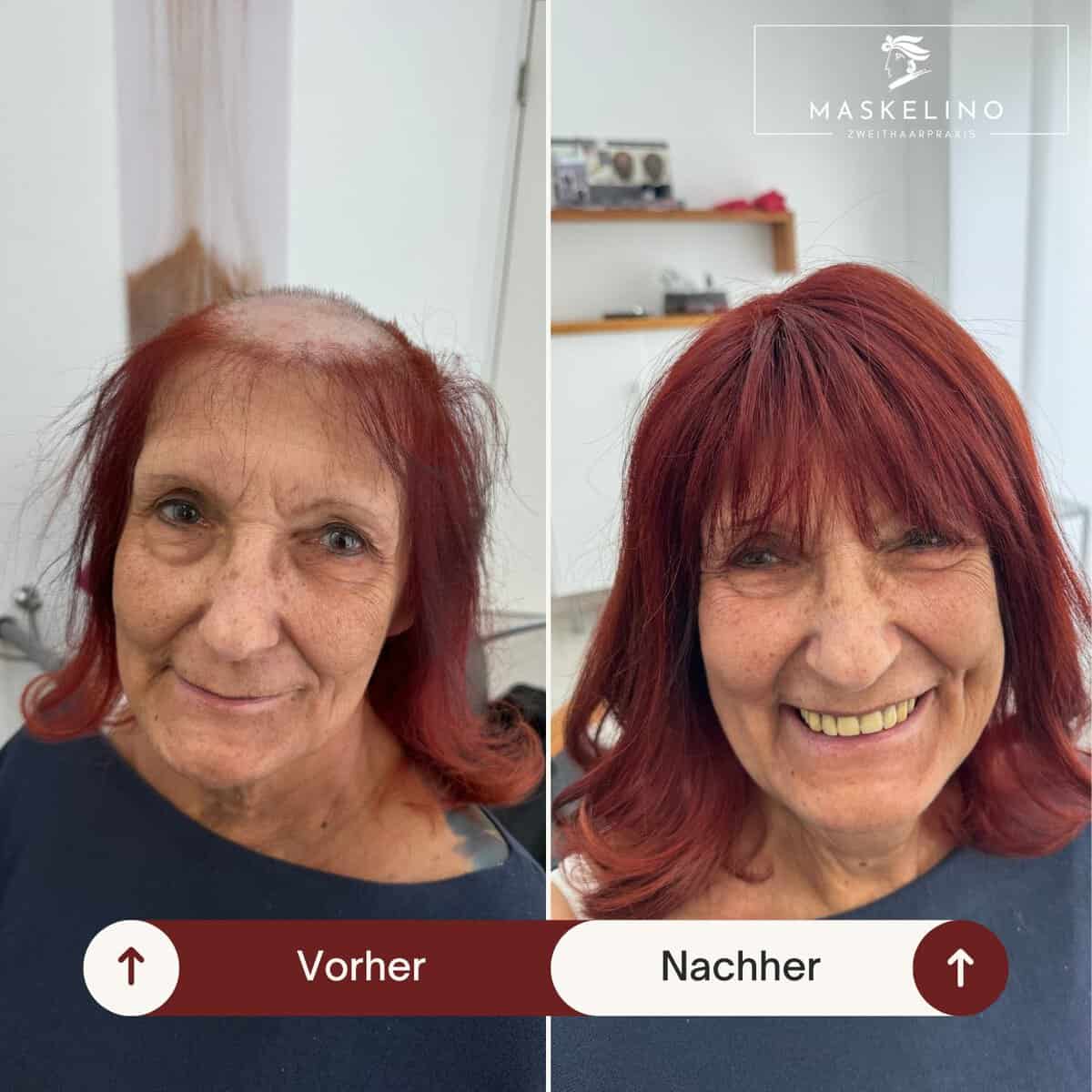 Maßgeschneidertes Haarteil für besondere Anlässe – Verwandlung im Zweithaarstudio