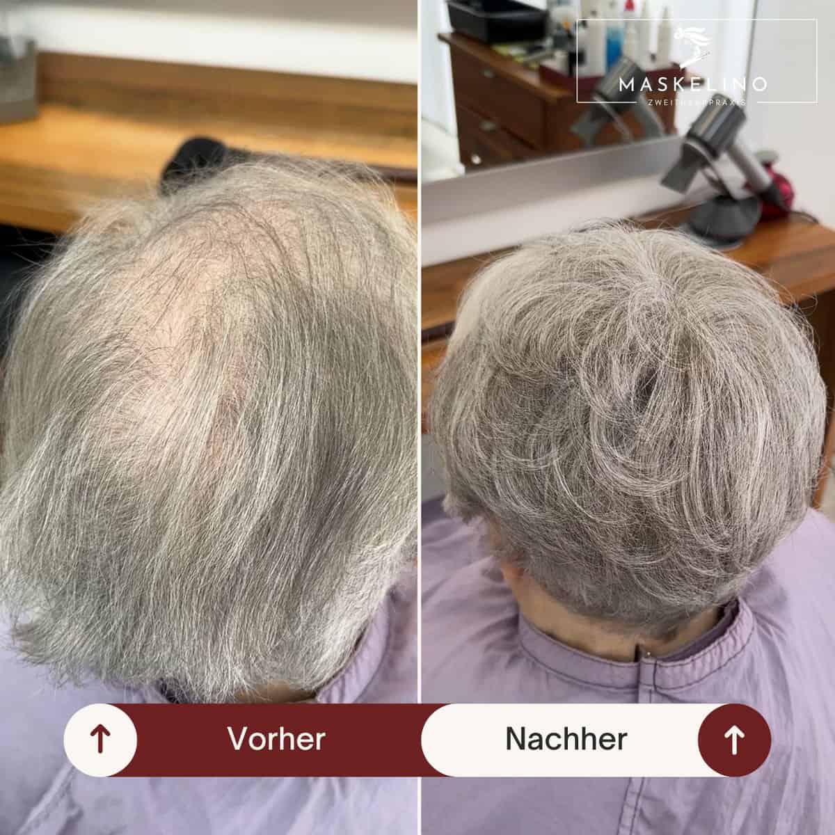 Haarteil Vorher und Nachher für mehr Fülle und Volumen im Haar